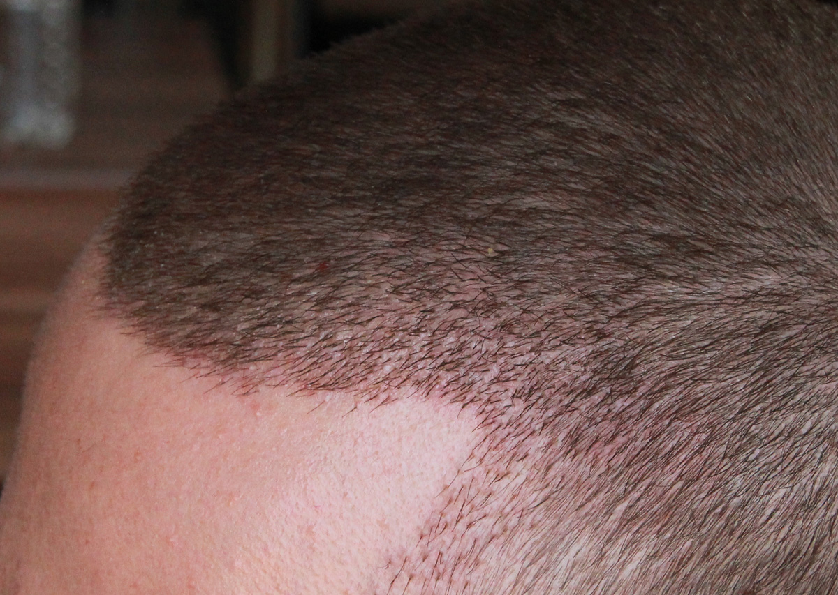 index.php/fa/17560/0/