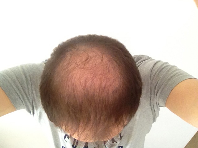 index.php/fa/17570/0/