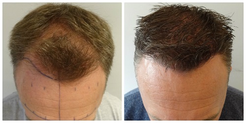 index.php/fa/17578/0/