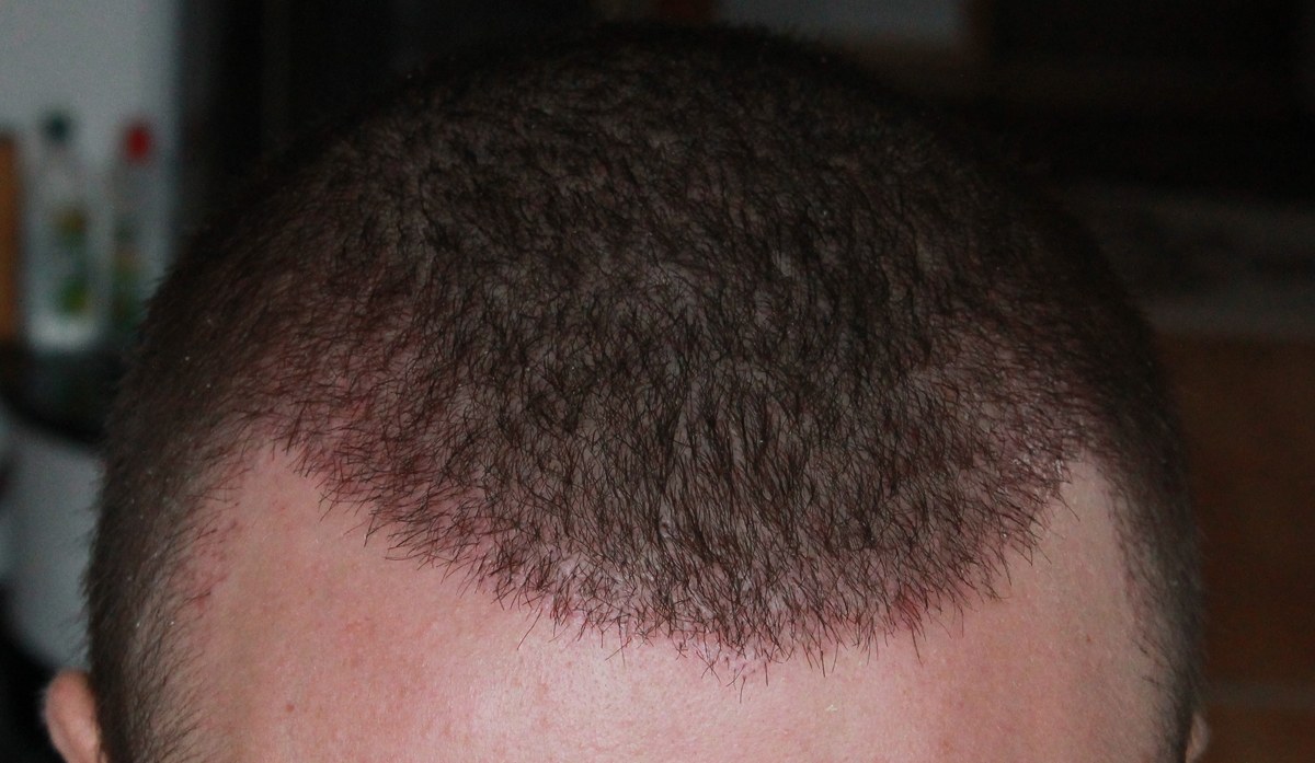 index.php/fa/17595/0/