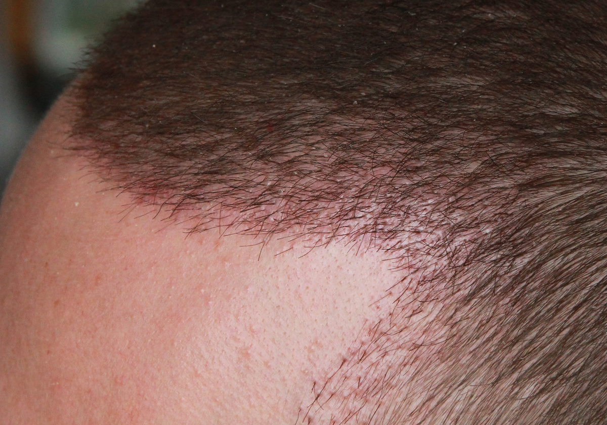 index.php/fa/17596/0/