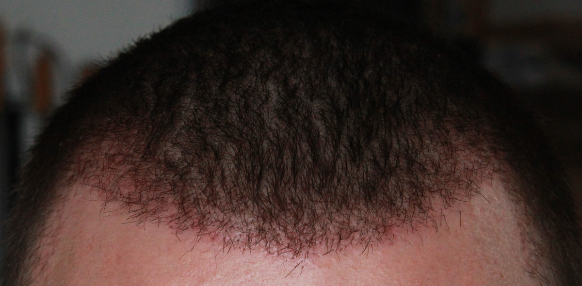 index.php/fa/17632/0/