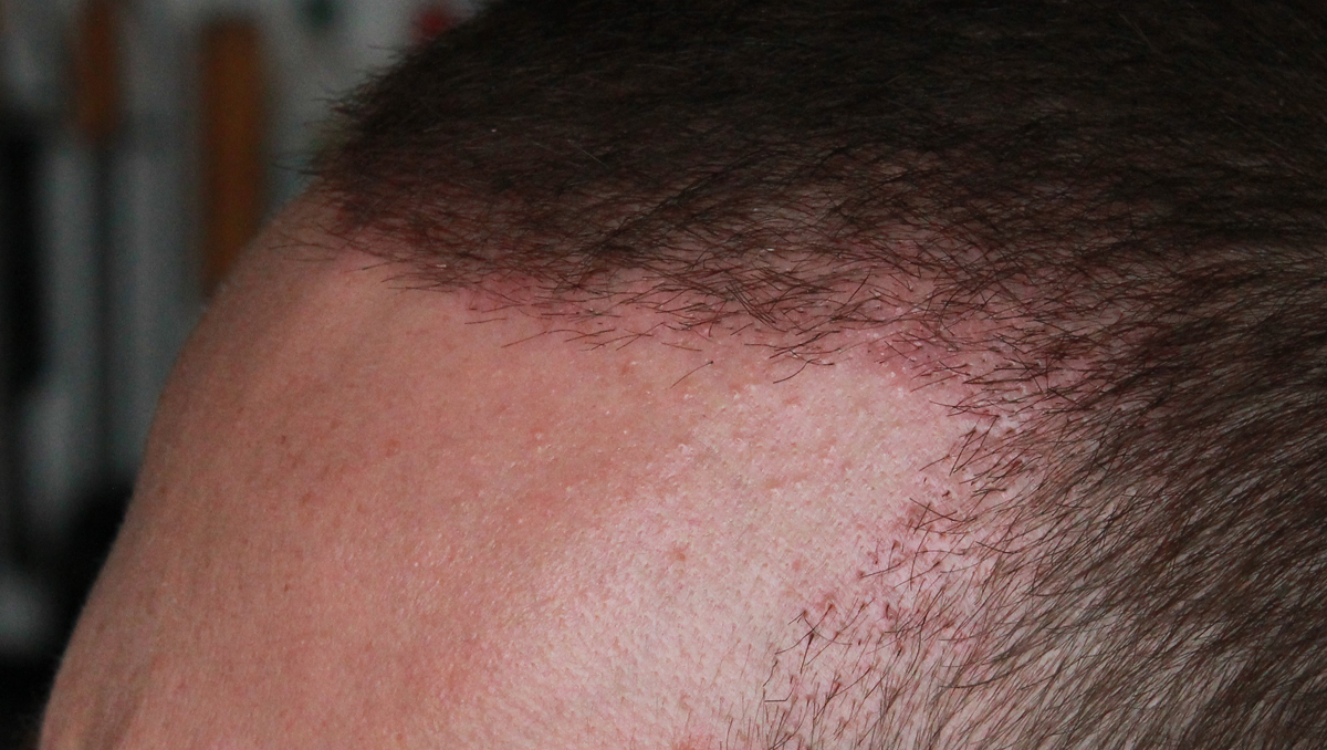 index.php/fa/17633/0/