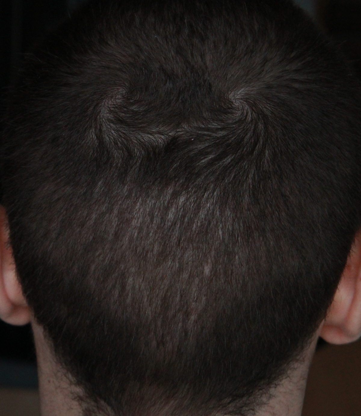 index.php/fa/17635/0/