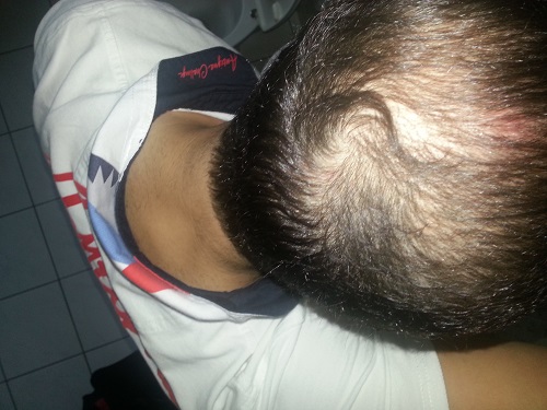 index.php/fa/17656/0/