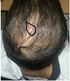 index.php/fa/17661/0/