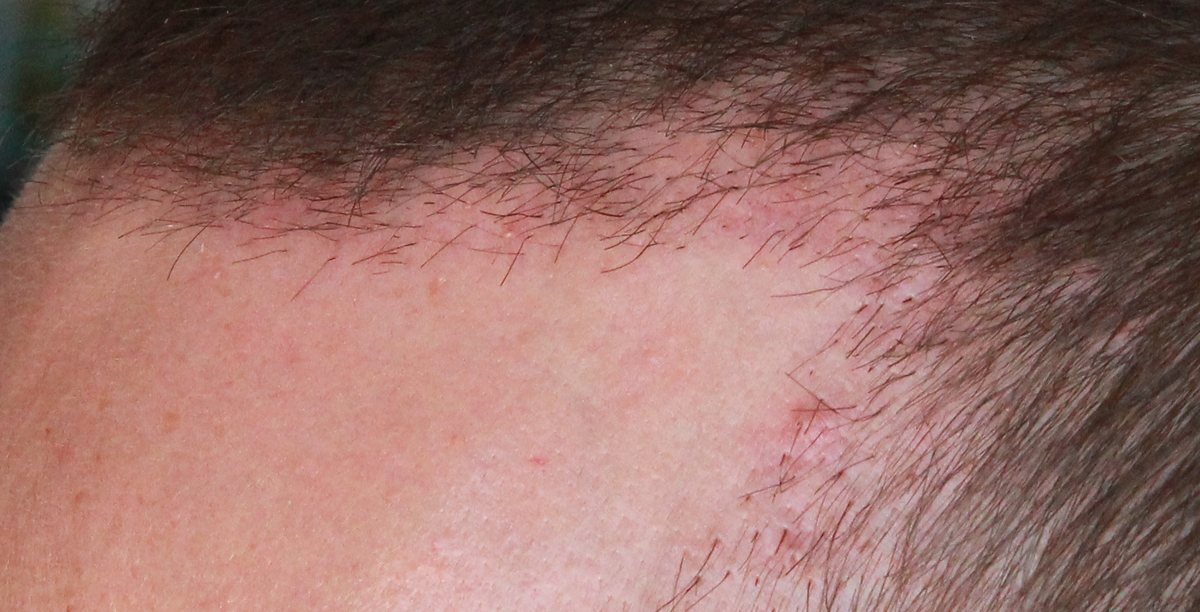 index.php/fa/17681/0/