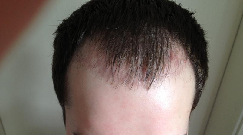 index.php/fa/17753/0/