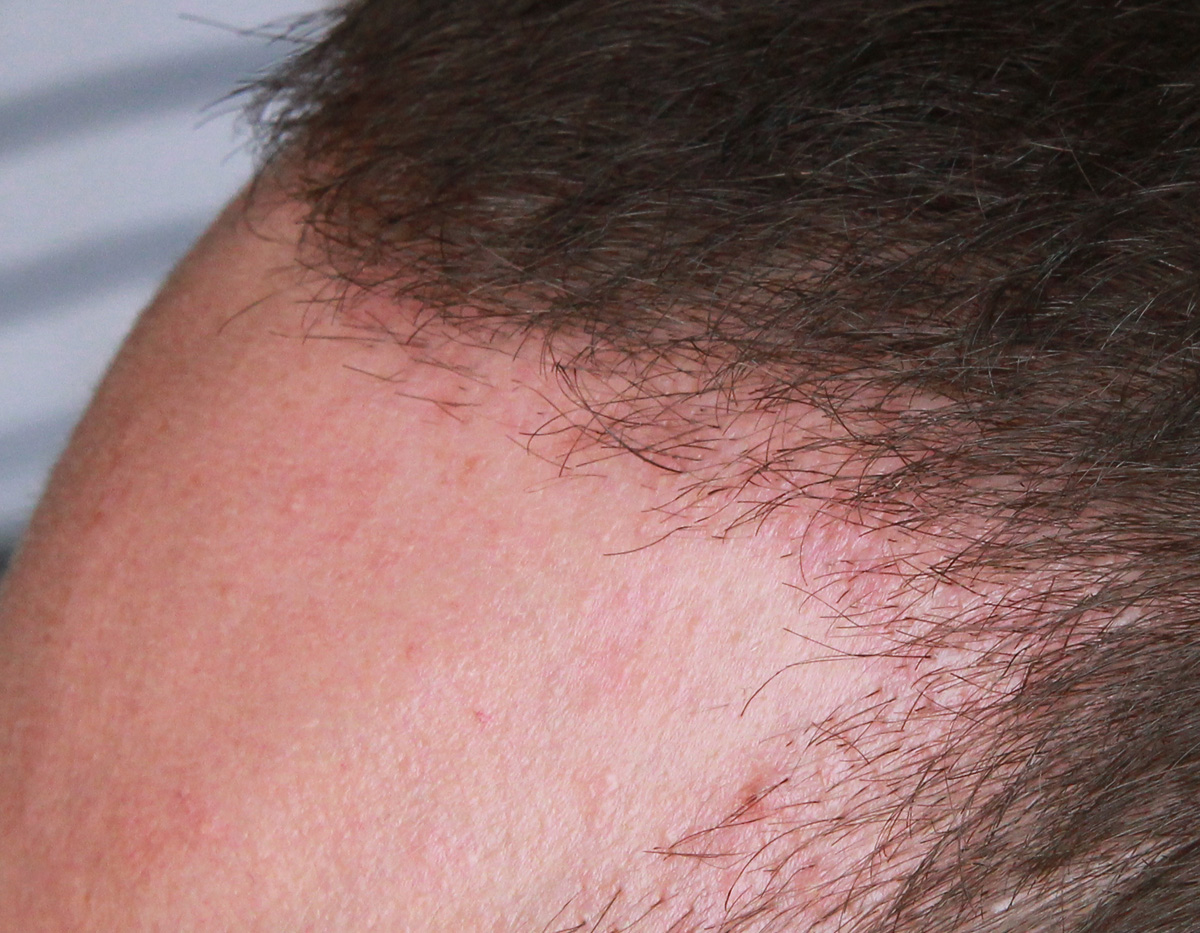 index.php/fa/17765/0/