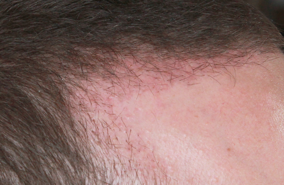 index.php/fa/17766/0/