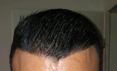 index.php/fa/17771/0/