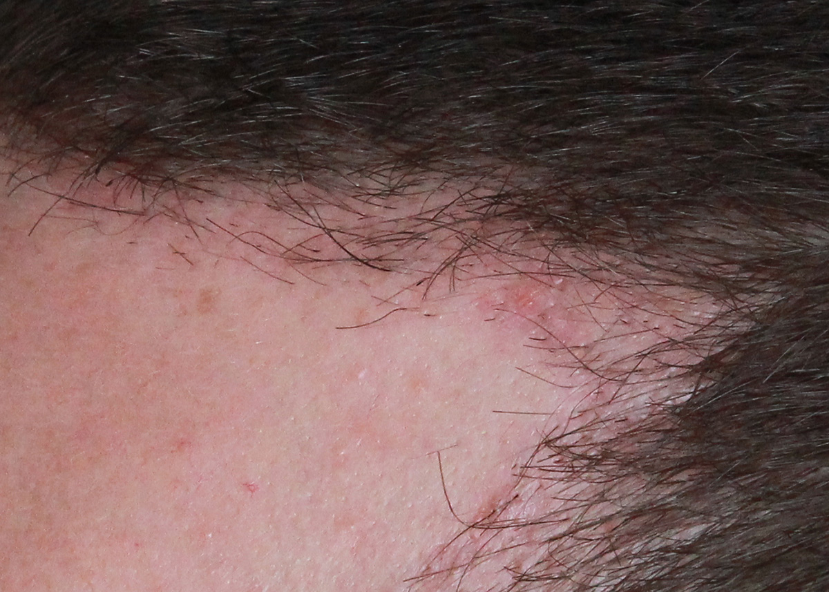 index.php/fa/17803/0/