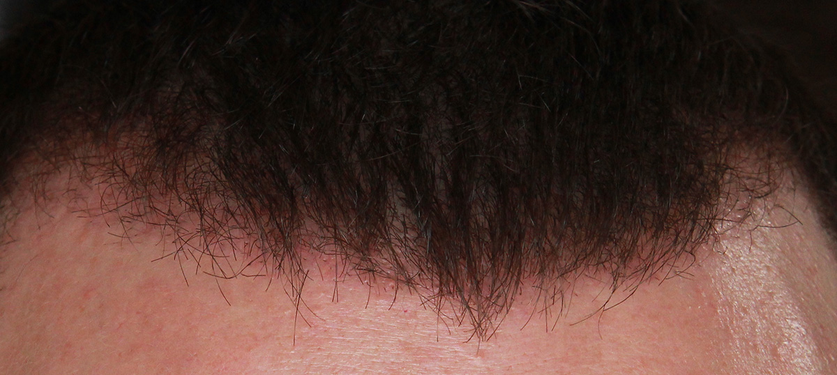 index.php/fa/17805/0/