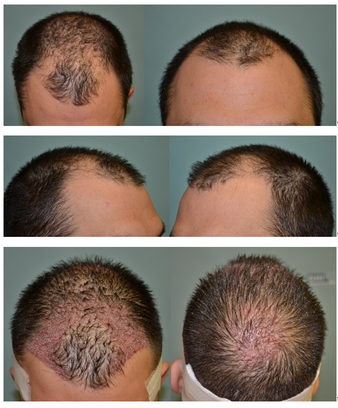 index.php/fa/17823/0/