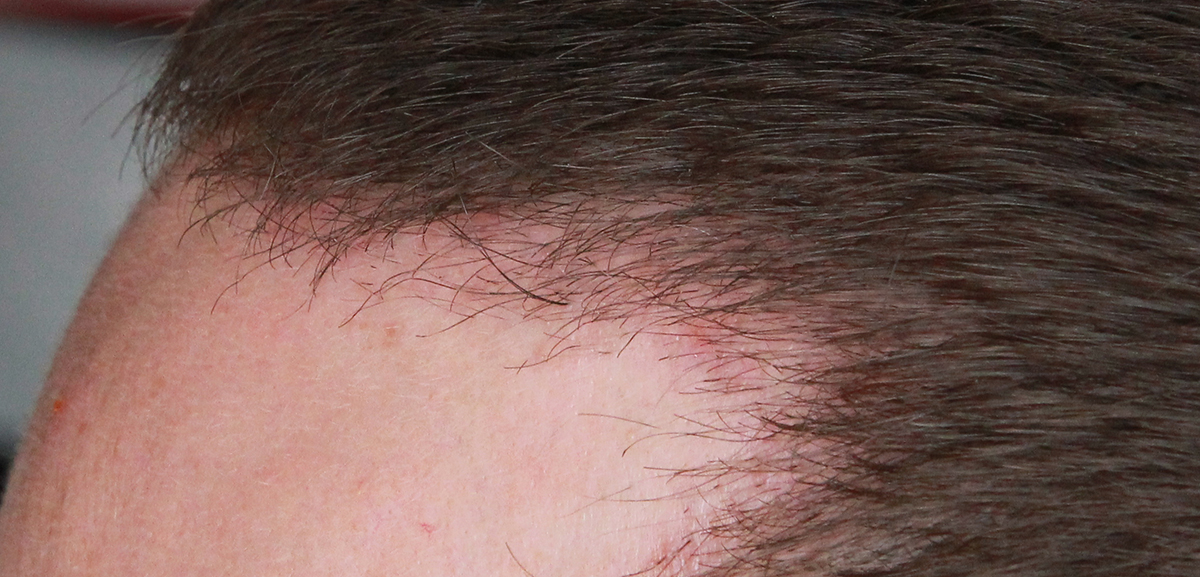 index.php/fa/17829/0/