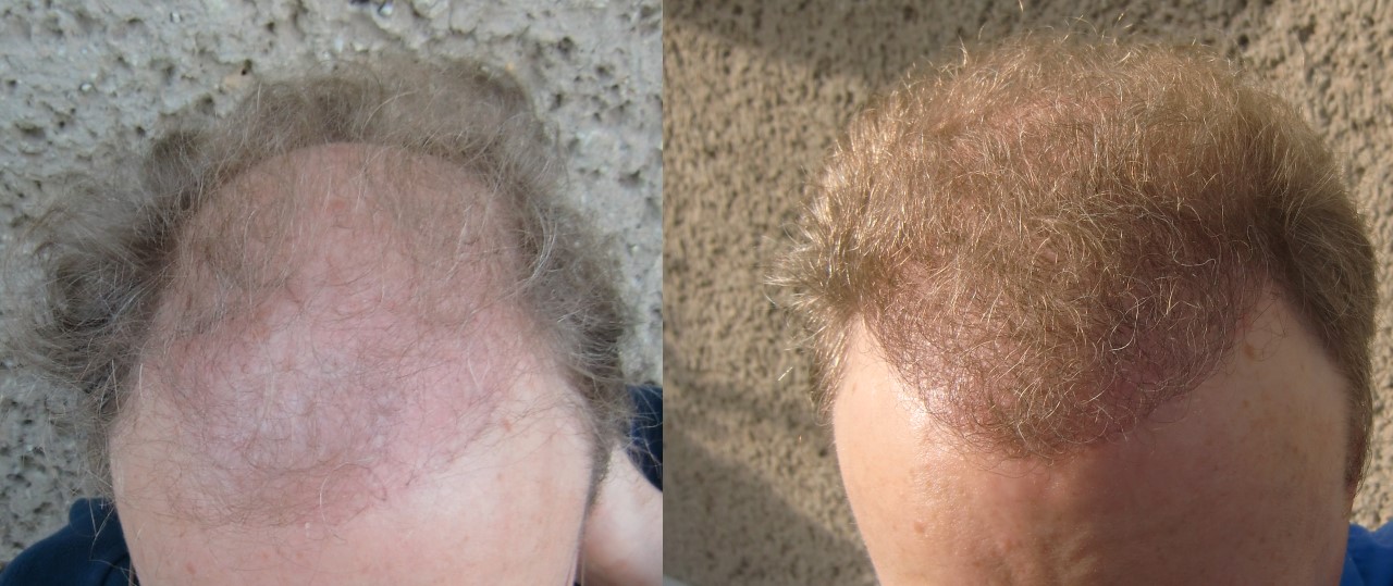 index.php/fa/17845/0/