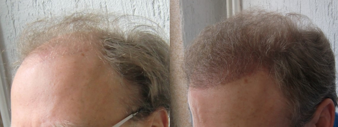 index.php/fa/17846/0/