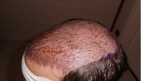 index.php/fa/17929/0/