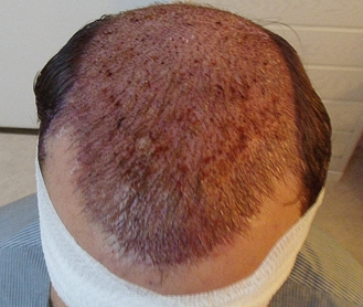 index.php/fa/17931/0/