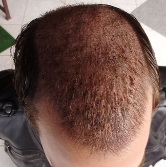 index.php/fa/17935/0/