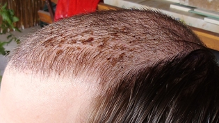 index.php/fa/17936/0/