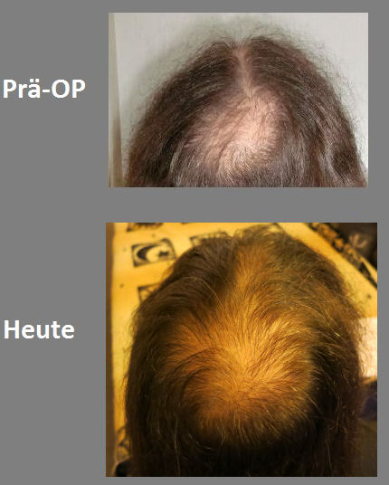 index.php/fa/17984/0/