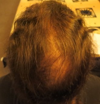 index.php/fa/17985/0/