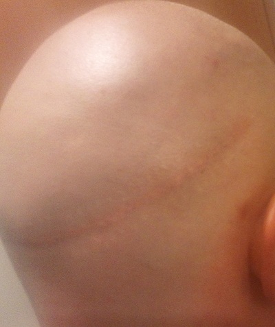 index.php/fa/18015/0/