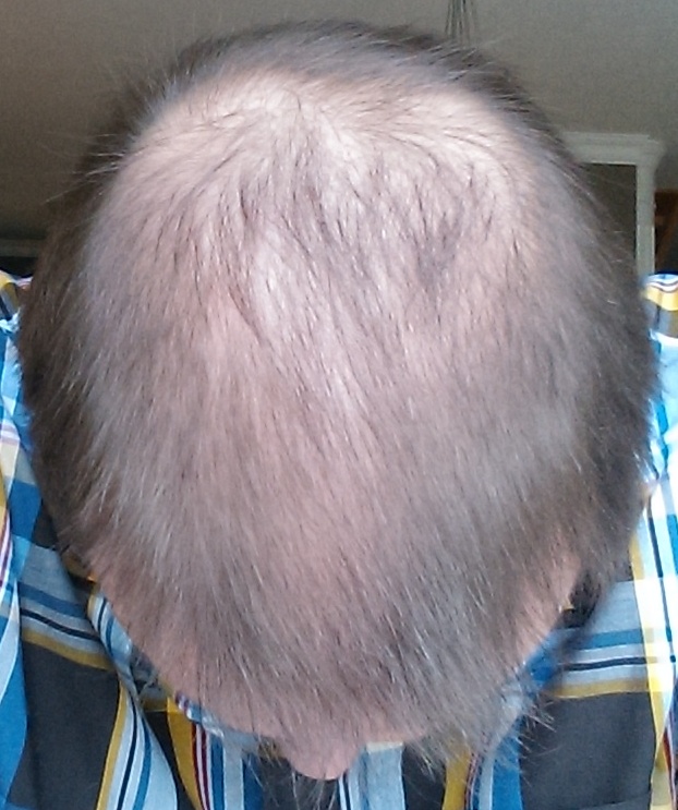 index.php/fa/18046/0/