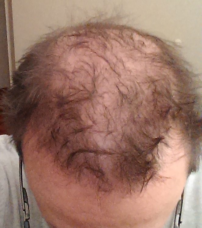 index.php/fa/18052/0/