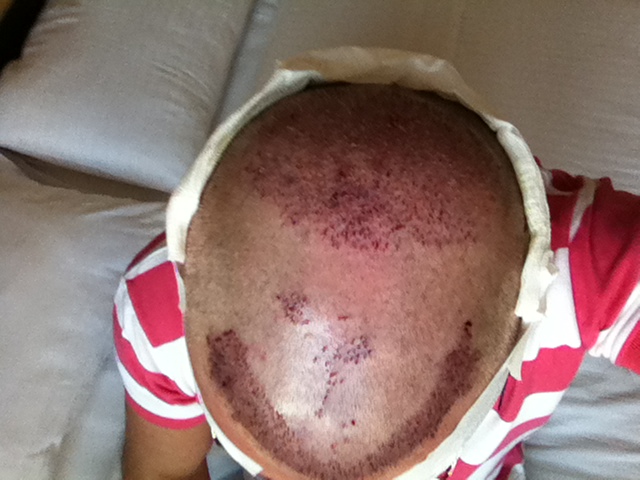 index.php/fa/18062/0/