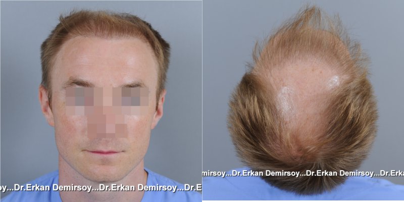 index.php/fa/18076/0/