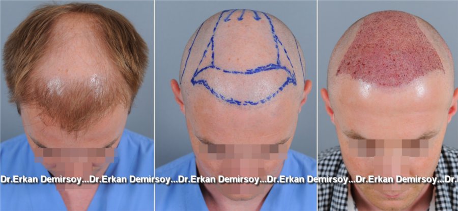 index.php/fa/18077/0/