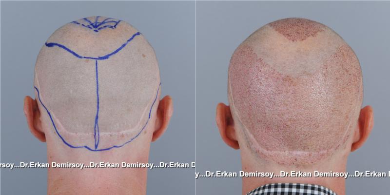 index.php/fa/18078/0/