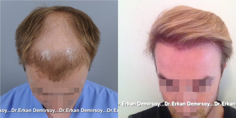 index.php/fa/18079/0/