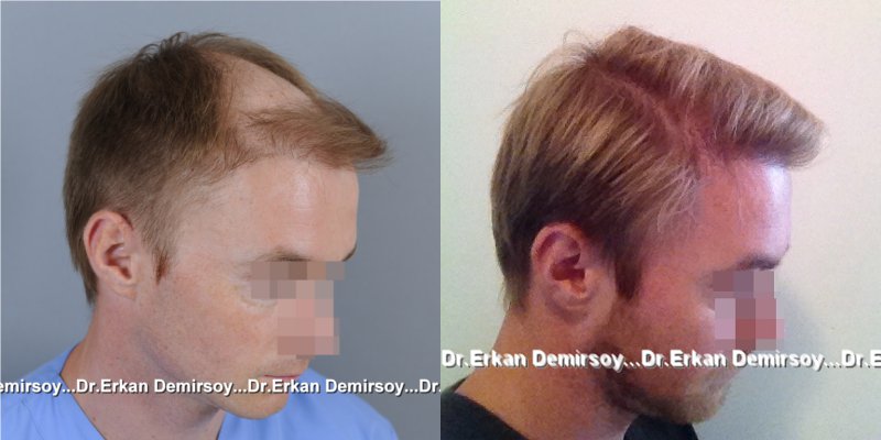 index.php/fa/18080/0/