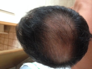 index.php/fa/18106/0/