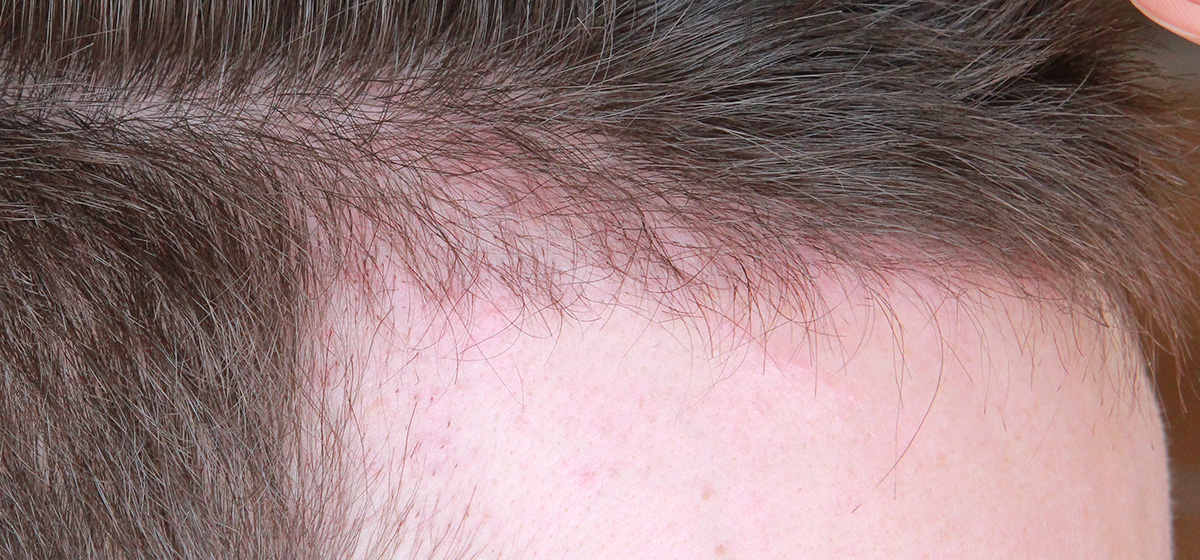 index.php/fa/18213/0/