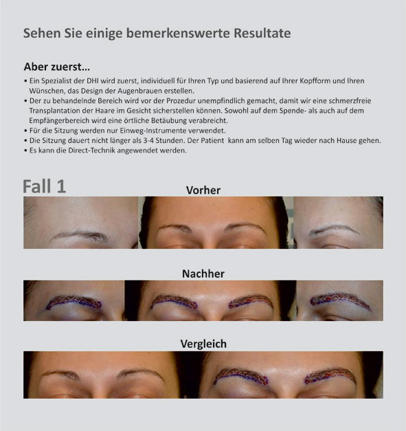 index.php/fa/18242/0/