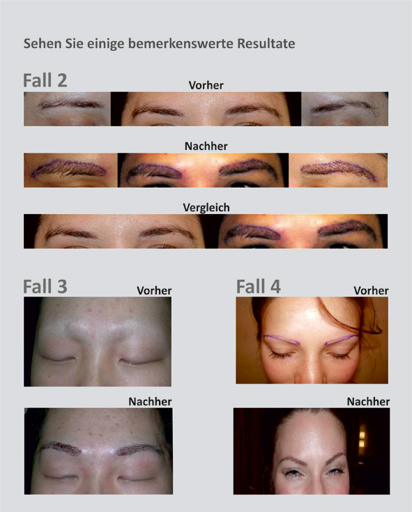 index.php/fa/18243/0/