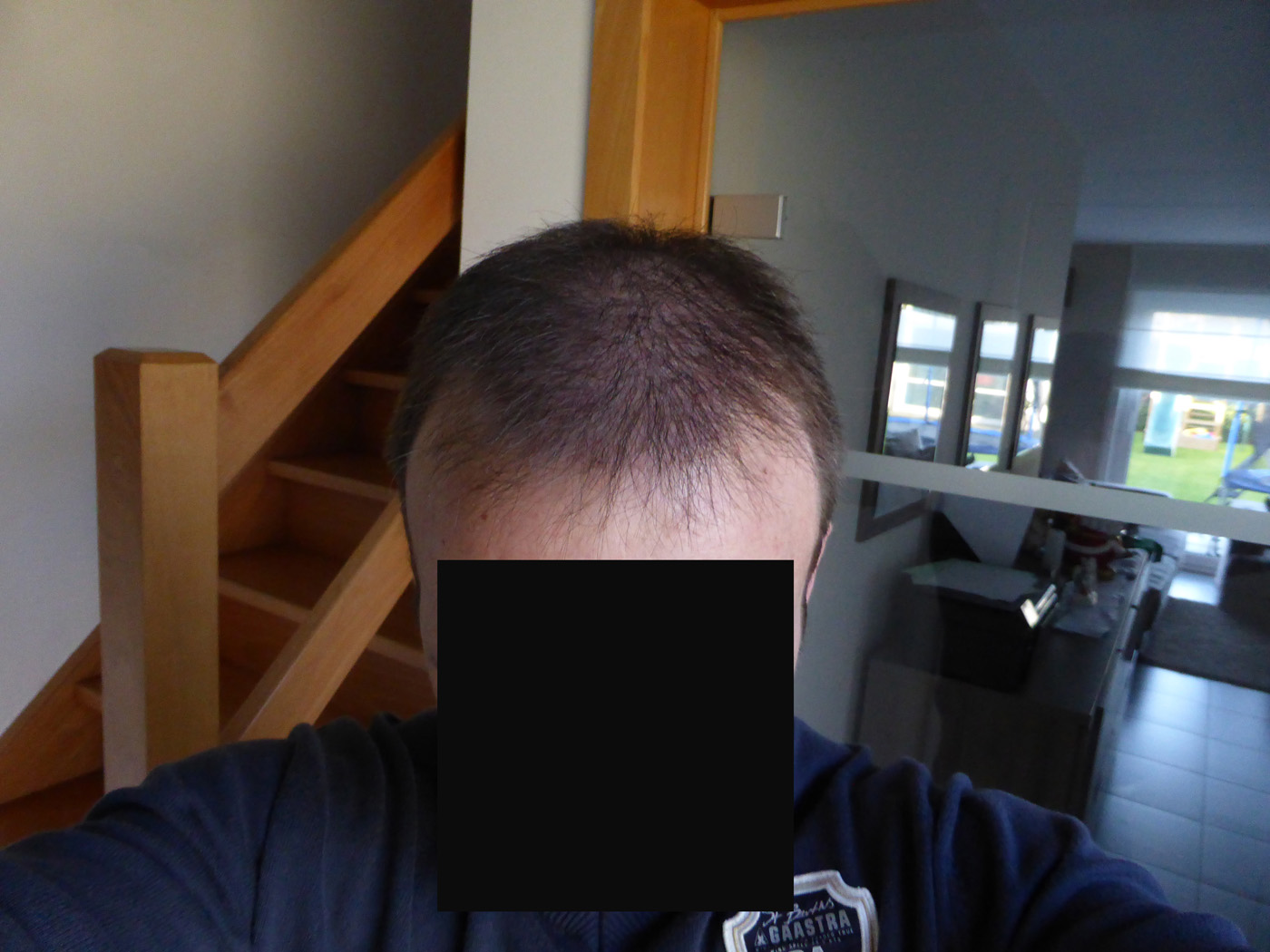 index.php/fa/18329/0/