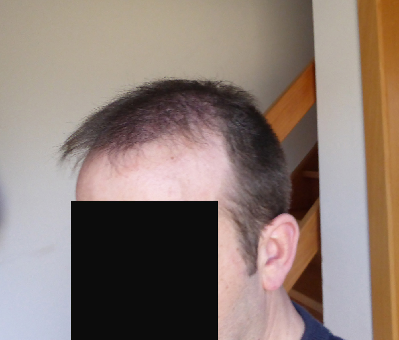 index.php/fa/18331/0/