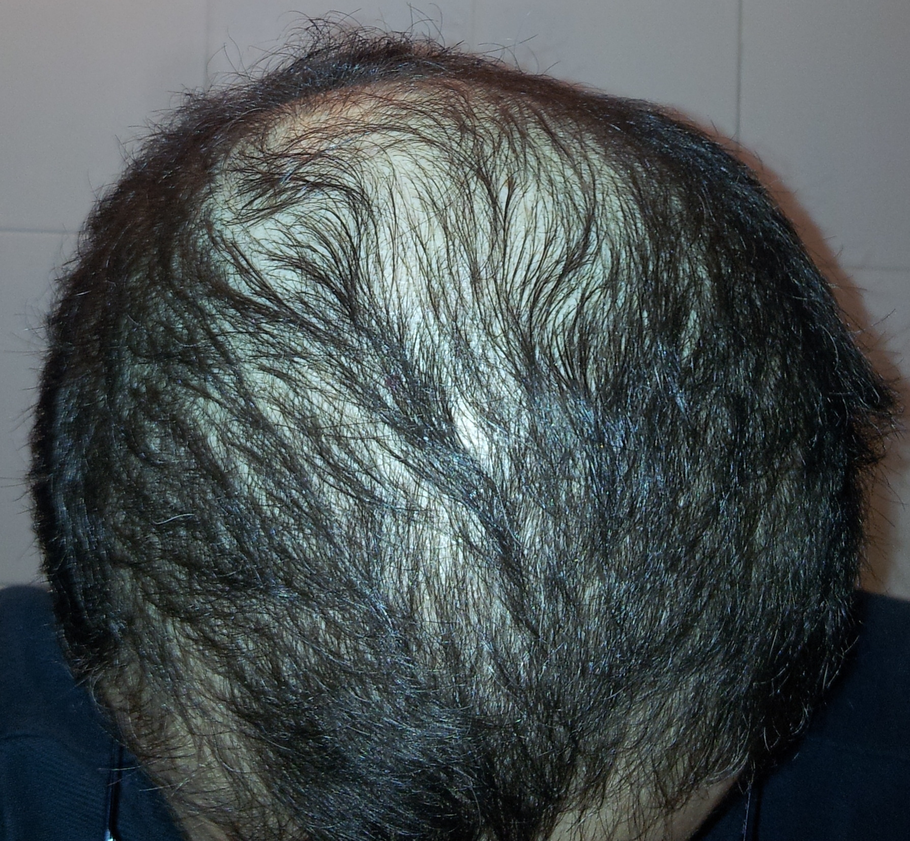 index.php/fa/18360/0/