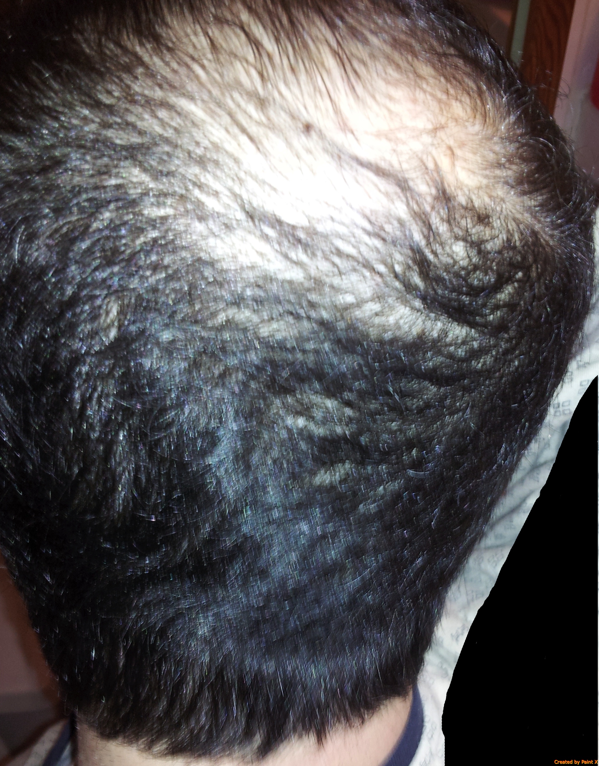 index.php/fa/18382/0/