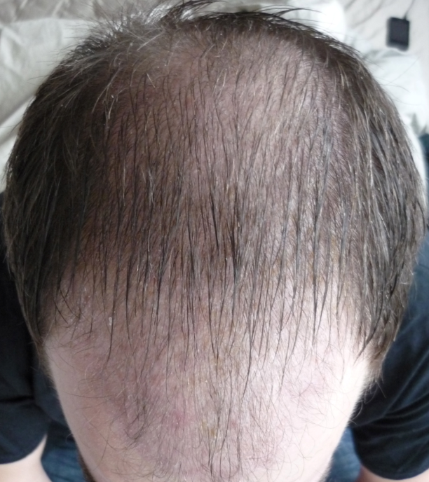 index.php/fa/18445/0/