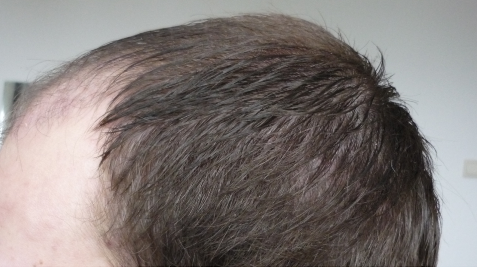 index.php/fa/18447/0/