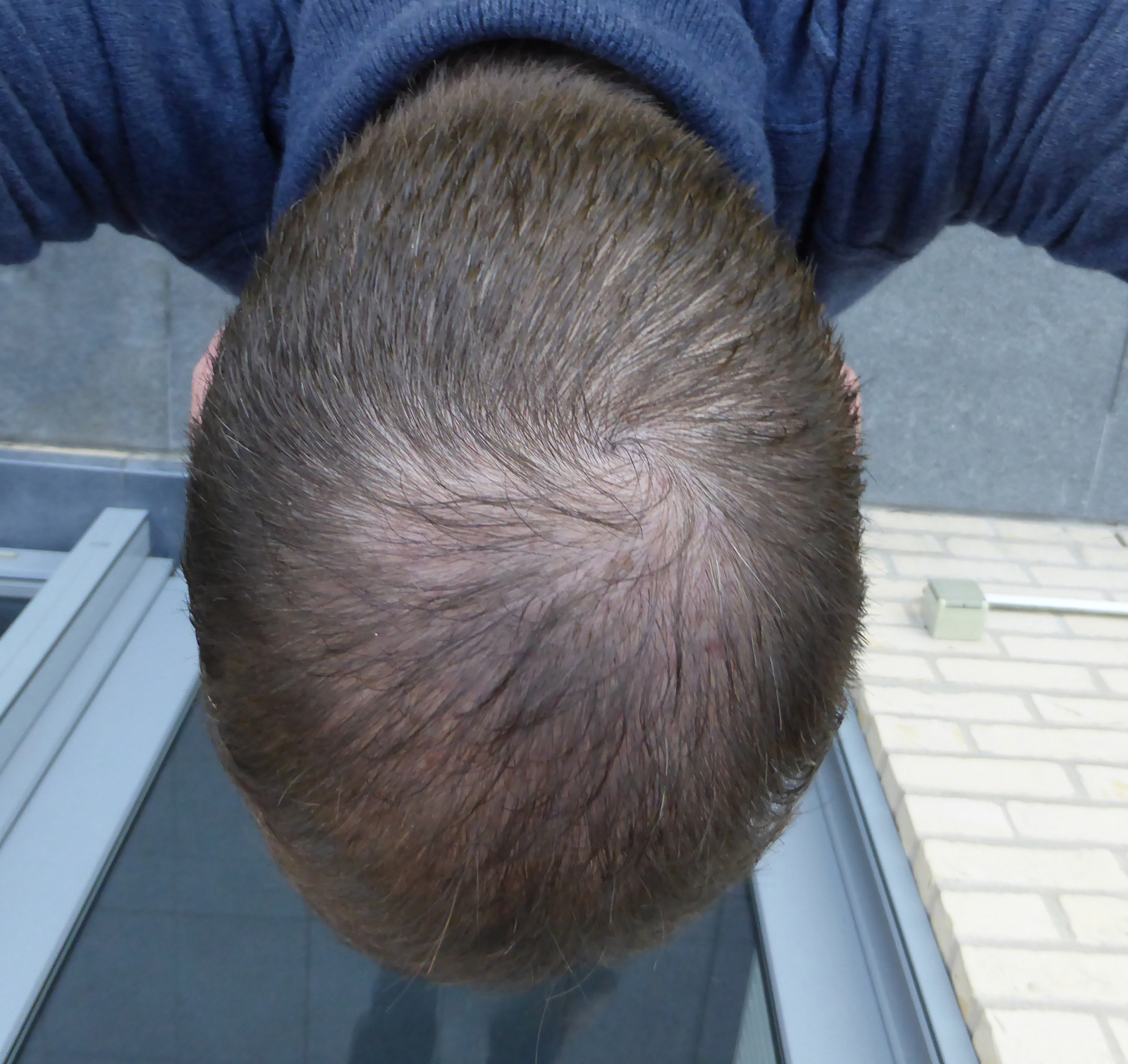 index.php/fa/18683/0/