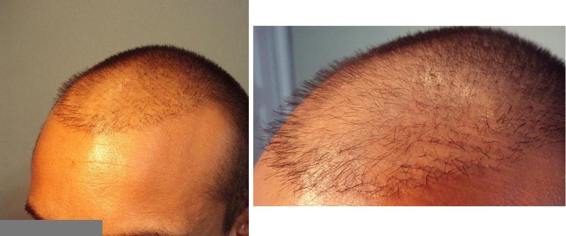 index.php/fa/1883/0/