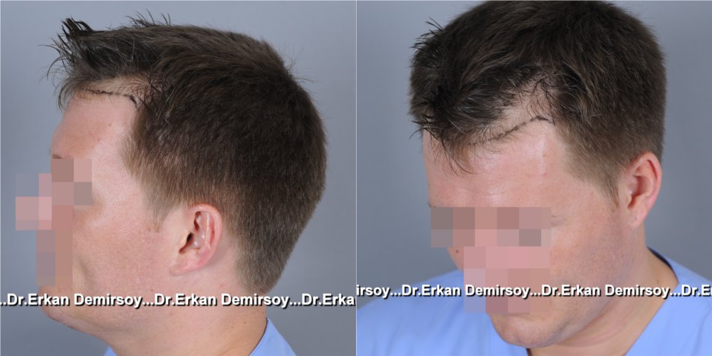 index.php/fa/18833/0/