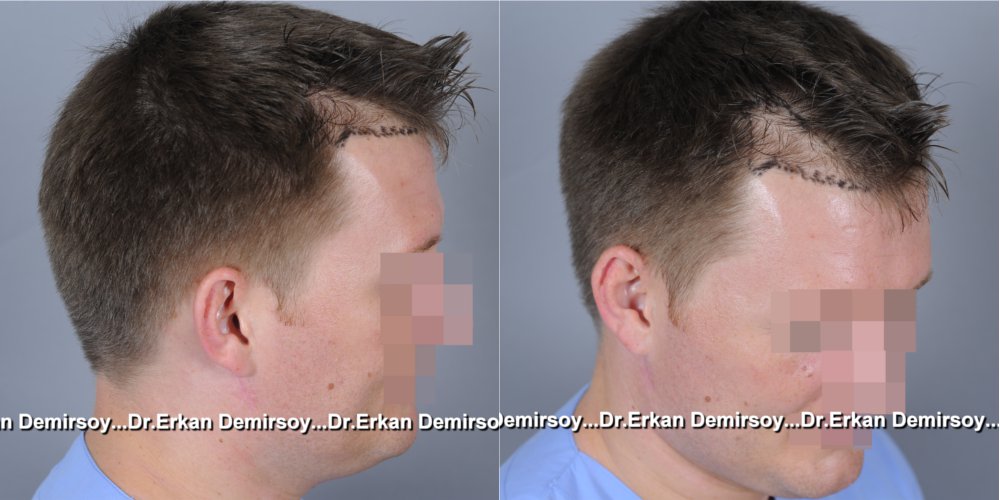 index.php/fa/18834/0/